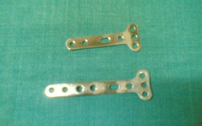 Here’s Who Just Picked Up Rti Surgical Inc. (NASDAQ:RTIX) Shares