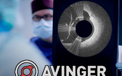 Avinger Inc (NASDAQ:AVGR) Is Up 60% in 2 Weeks: What’s Next?