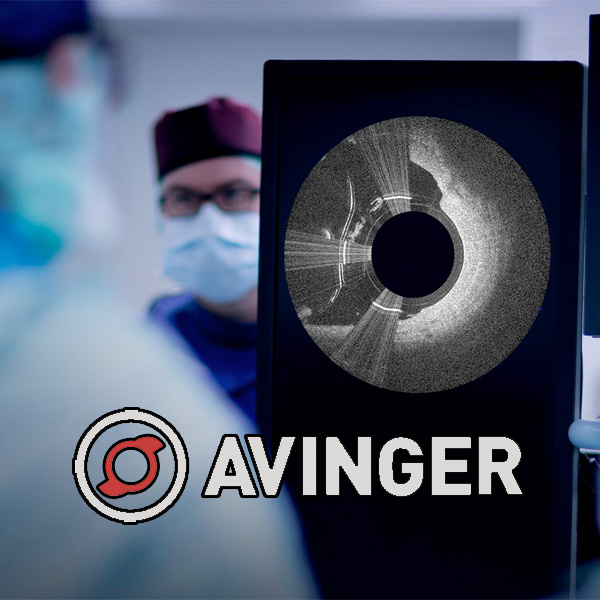 Avinger Inc (NASDAQ:AVGR)