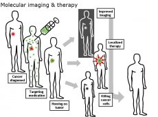 MolecularImagingTherapy